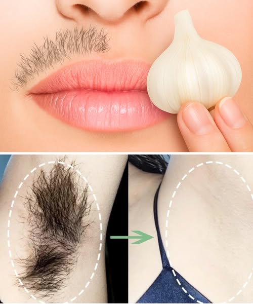 Stop Shaving Forever: 7 Proven Ways to Permanently Get Rid of Facial, Body, and Pubic Hair
