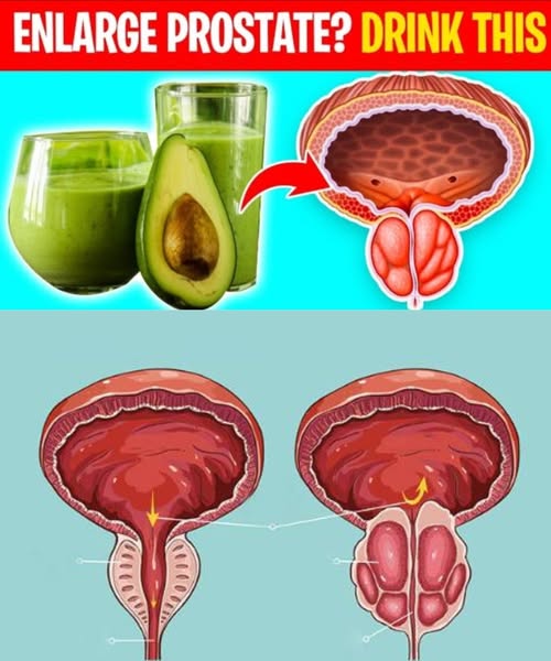 8 Powerful Drinks to Naturally Shrink an Enlarged Prostate Fast 🍵 | Doctor-Backed Remedies That Actually Work!