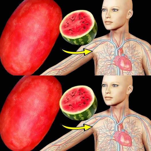 🍉 What Happens To Your Body When You Eat Watermelon Every Day? 12 Amazing Health Effects You Must Know!