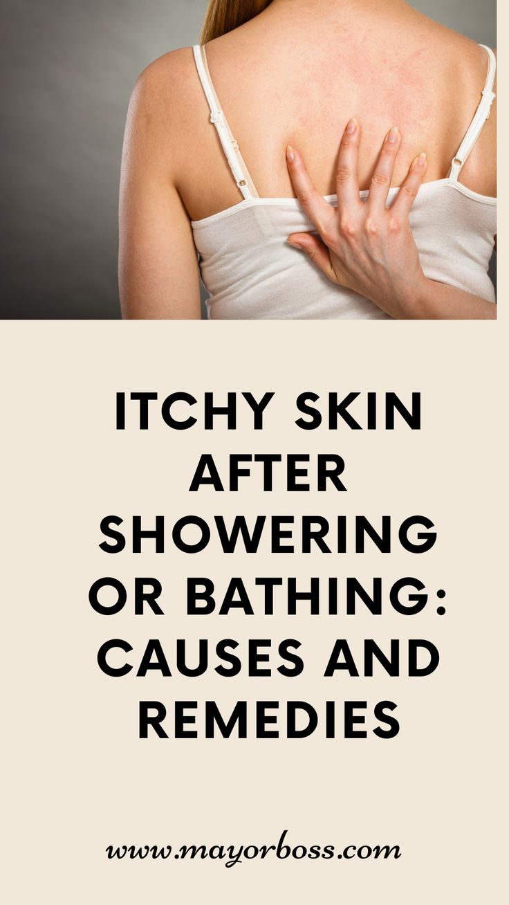 Stop That Itch Fast! ✅ How to Solve Body Itching After Bath: Causes, Solutions, and Expert Tips