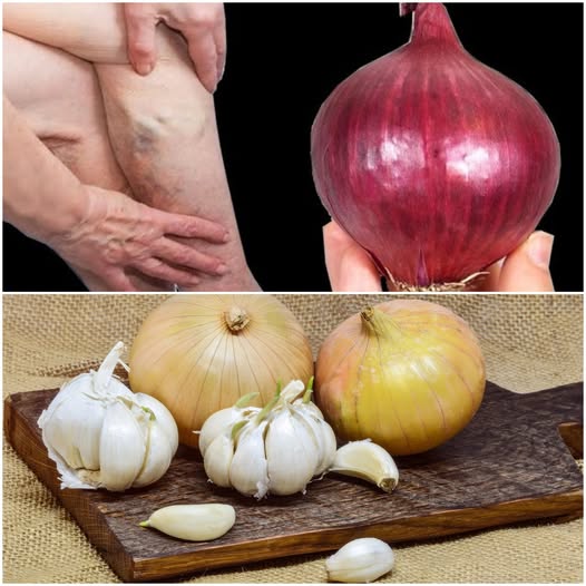 💥 7 Powerful Natural Remedies from Mom’s Cabinet for Leg Pain, Rheumatism, Varicose Veins, Arthritis, Headache, and Joint Pain