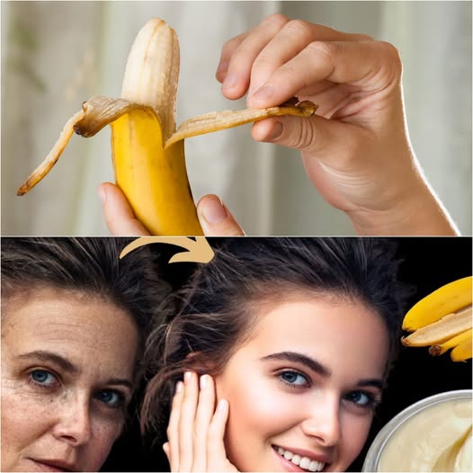 Banana Peel and Cornstarch Erase Wrinkles Instantly: The 100-Year-Old Anti-Wrinkle Secret You Need Today