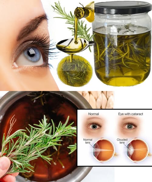 The Natural Secret That Kills Cataracts, Restores Vision, and Relieves Eye Inflammation