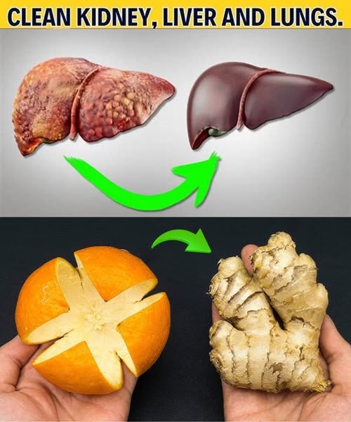 Clean Your Kidney, Liver, and Lungs Naturally: The Ultimate Bacteria Killer That Flushes Out Toxins Fast